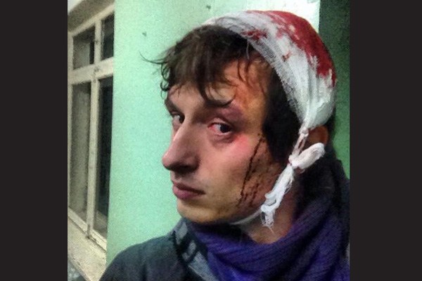 «Беркут» избил на Майдане около полусотни журналистов