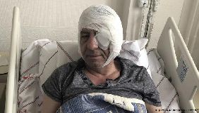 У Туреччині невідомі побили бейсбольними бітами журналіста, який критикував Ердогана