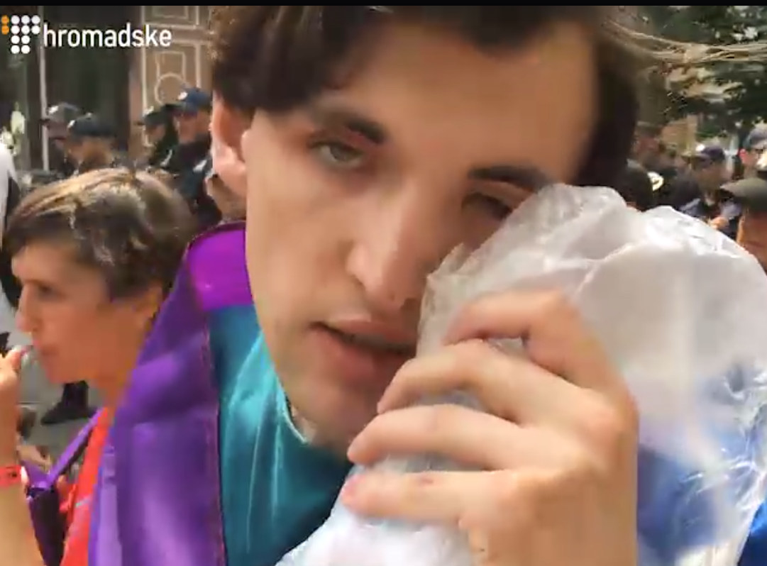 У Києві під час Маршу рівності постраждав журналіст «Громадського»