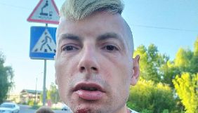 CPJ закликав українську владу негайно розслідувати напад на блогера Ігоря Стаха