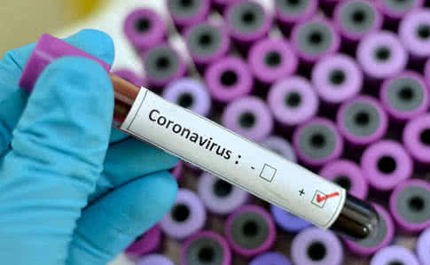 На каналах Медведчука владу звинувачують у спекуляціях на коронавірусі – моніторинг