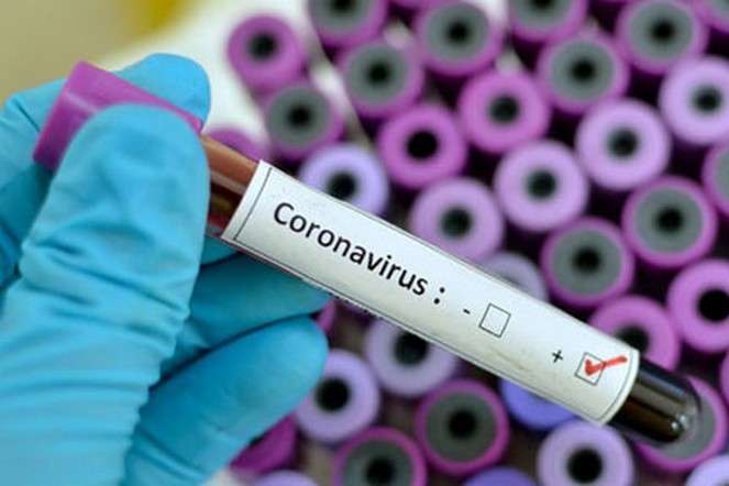 Як писати про коронавірус: детальні поради для журналістів