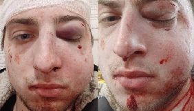 Прокуратура порушила справу за фактом побиття журналіста Obozrevatel