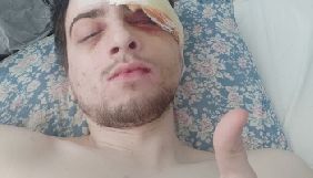 Побитий журналіст Obozrevatel переніс кілька операцій