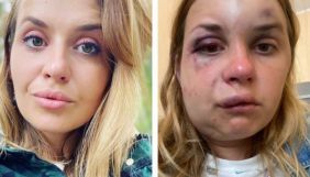&laquo;Нещасний випадок&raquo; чи &laquo;зумисні дії&raquo;. &laquo;Укрзалізниця&raquo; вивчає, як кваліфікувати побиття журналістки &laquo;Інтера&raquo;