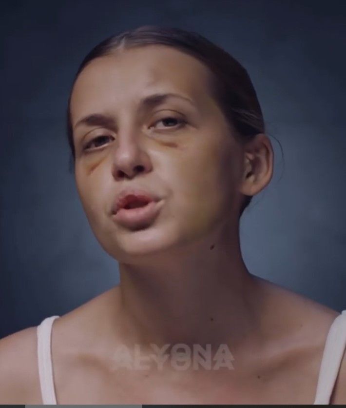 Журналістка «Інтера» Анастасія Лугова стала героїнею кліпу Alyona Alyona