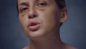 Журналістка «Інтера» Анастасія Лугова стала героїнею кліпу Alyona Alyona