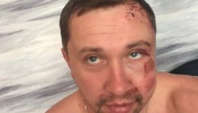 У Житомирі напали на головреда місцевої газети. Поліція каже, це не пов'язане з професійною діяльністю