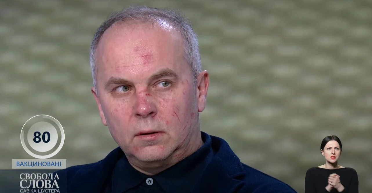 &laquo;Струс мозку&raquo; та &laquo;заходи від сказу&raquo;: Шуфрич розповів про свій стан після бійки з Бутусовим