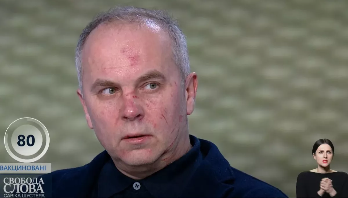 &laquo;Струс мозку&raquo; та &laquo;заходи від сказу&raquo;: Шуфрич розповів про свій стан після бійки з Бутусовим