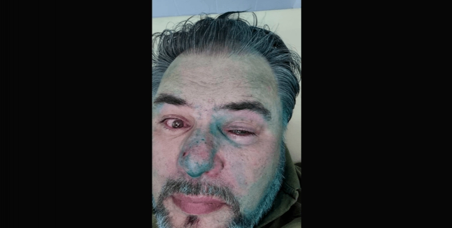 Оновлення Дошки ганьби: серед тих, хто виправдовує агресора — Теліженко, Кузьмін, Жаркіх і Коцаба