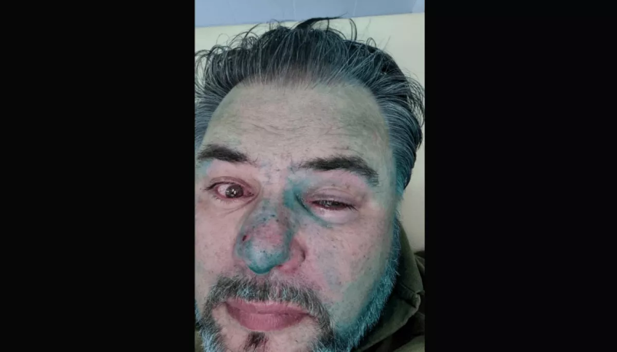 Оновлення Дошки ганьби: серед тих, хто виправдовує агресора — Теліженко, Кузьмін, Жаркіх і Коцаба
