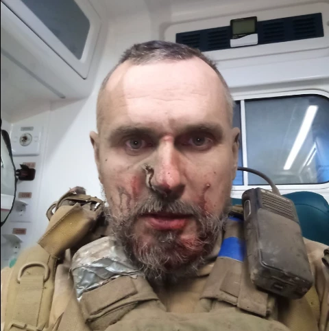 Олег Сенцов потрапив під артилерійський обстріл росіян