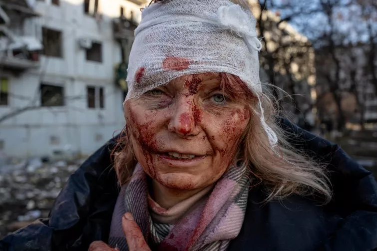 Американський фотограф отримав нагороду International Photography Awards за фото про війну в Україні