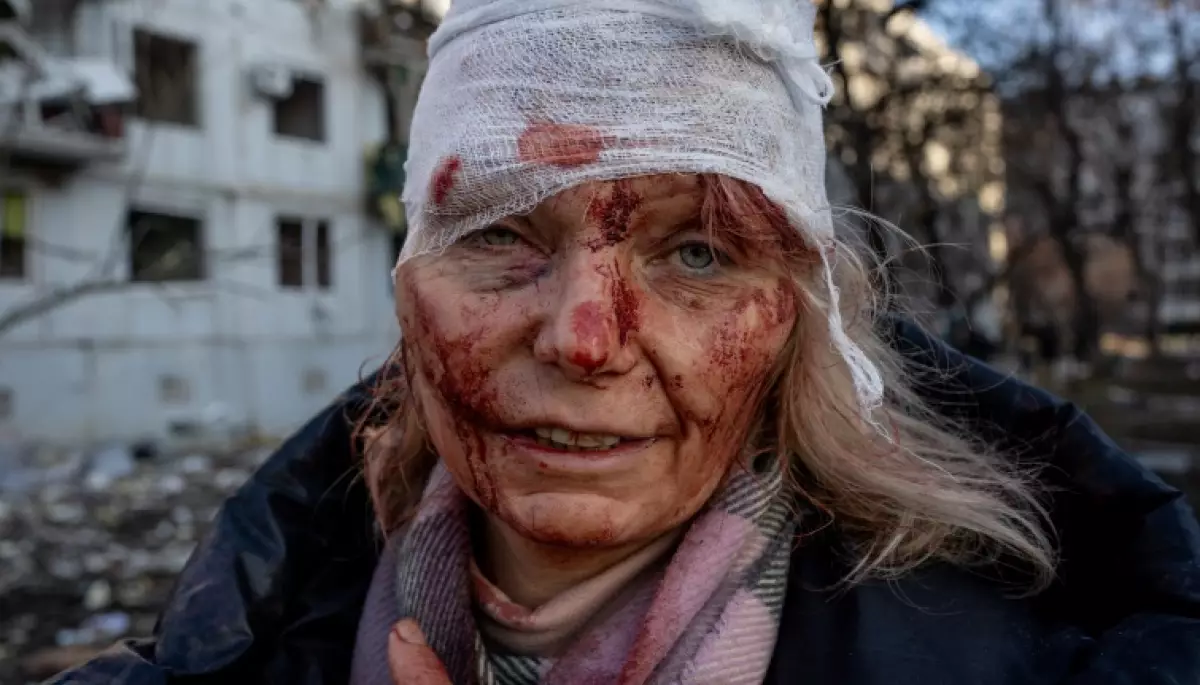 Американський фотограф отримав нагороду International Photography Awards за фото про війну в Україні