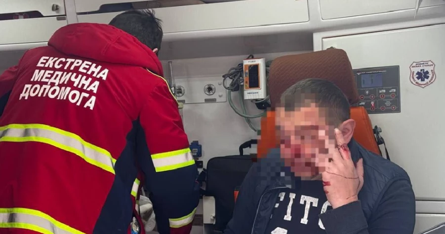 Невідомі напали на спецкореспондента видання &laquo;Свої. Кривий Ріг&raquo;
