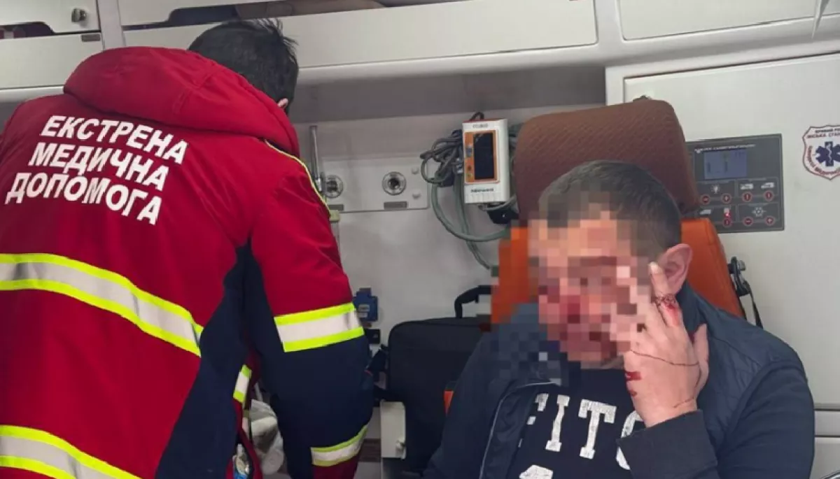 Невідомі напали на спецкореспондента видання &laquo;Свої. Кривий Ріг&raquo;