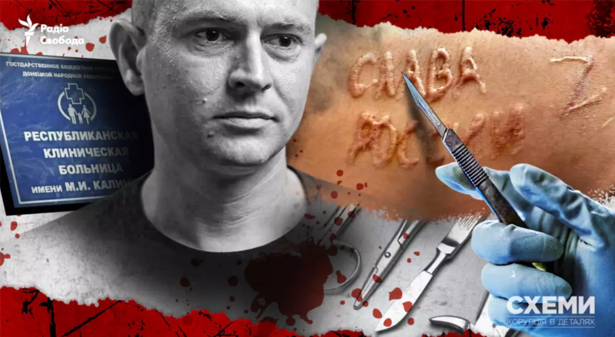&laquo;Схеми&raquo; ідентифікували російських хірургів, які могли випалити &laquo;слава России&raquo; на тілі українського полоненого