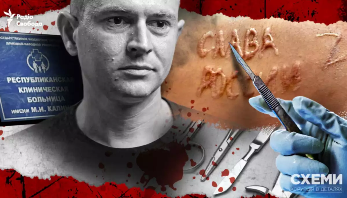 &laquo;Схеми&raquo; ідентифікували російських хірургів, які могли випалити &laquo;слава России&raquo; на тілі українського полоненого