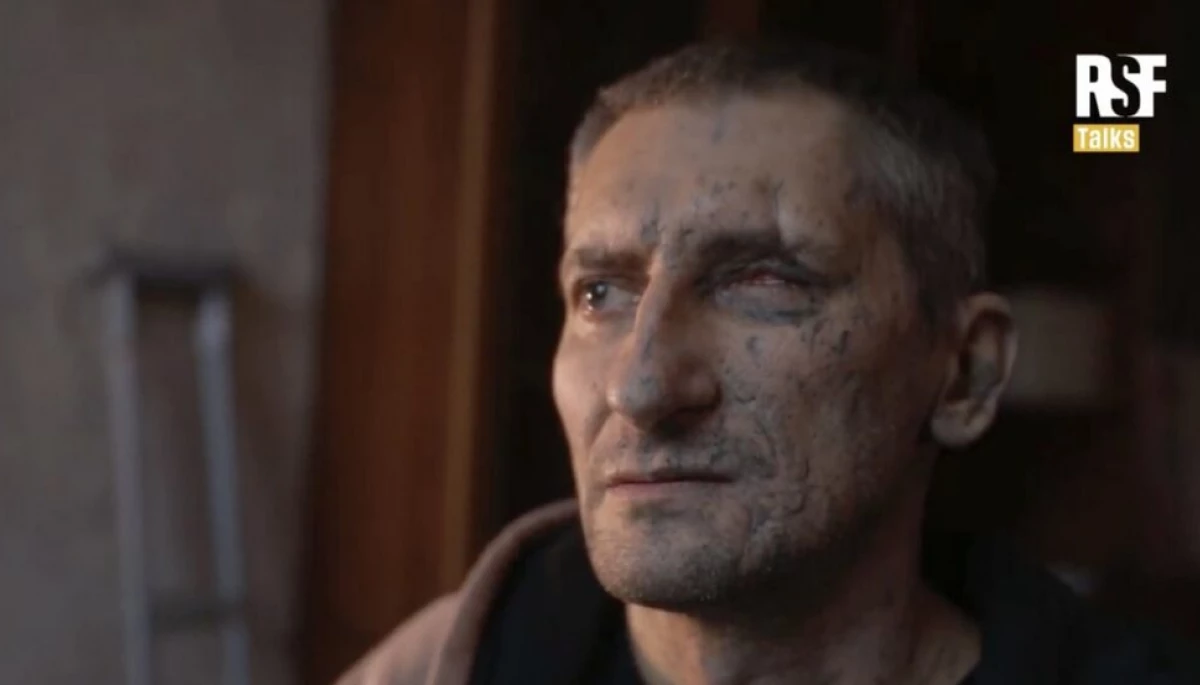 Держкомтелерадіо підписав наказ про виплату коштів пораненому кореспонденту Олександру Количеву