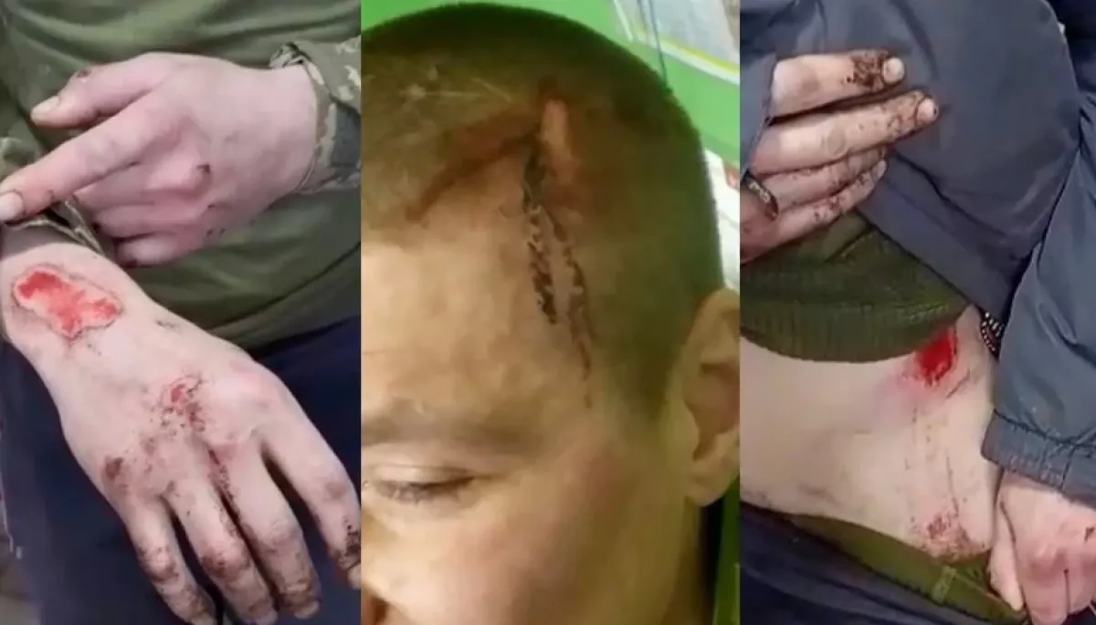 &laquo;Бабель&raquo; оприлюднив розслідування про небойові смерті новобранців у полку &laquo;Скеля&raquo;